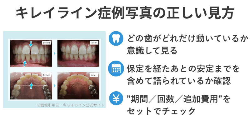 キレイライン症例写真の正しい見方まとめ