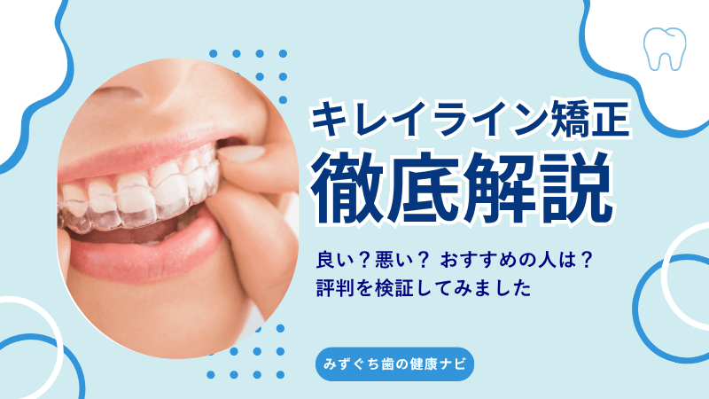 キレイラインの口コミ総まとめ｜良い・悪い評判を検証！おすすめの人は？のアイキャッチ画像