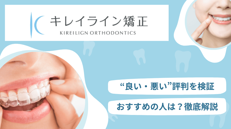 キレイラインの口コミ総まとめ｜良い・悪い評判を検証！おすすめの人は？のアイキャッチ画像