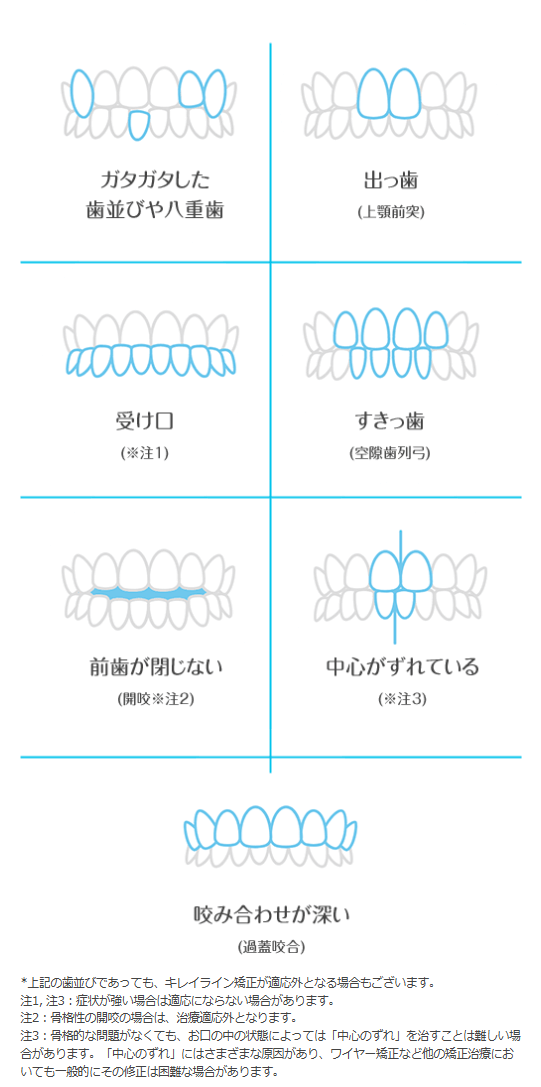 キレイライン矯正で対応できる歯並び一覧