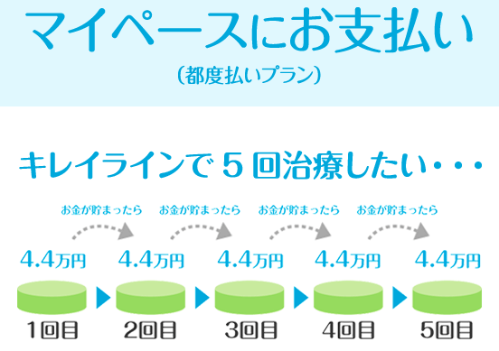 キレイライン矯正の都度払いのイメージ図
