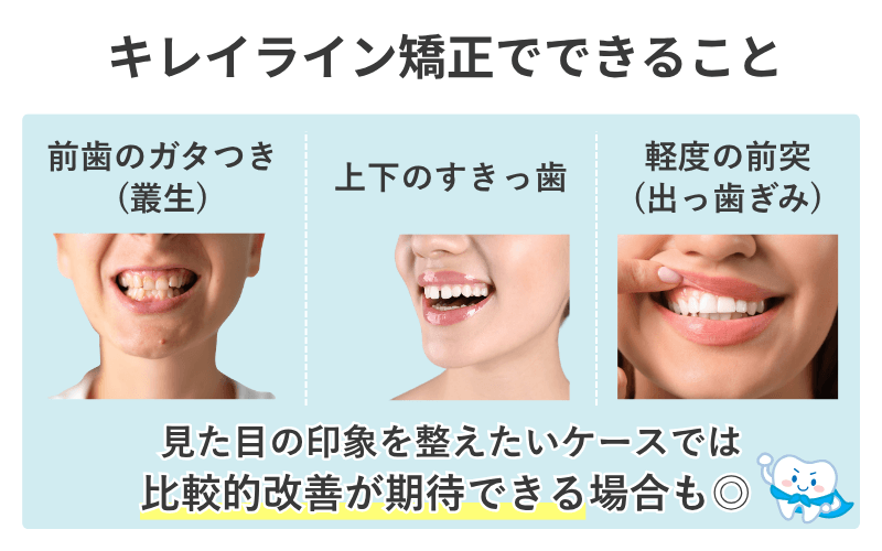 キレイライン矯正でできること（前歯の軽度な乱れやすきっ歯など）と、苦手なこと（奥歯の大きな移動や骨格性の不正咬合など）を対比した図解表