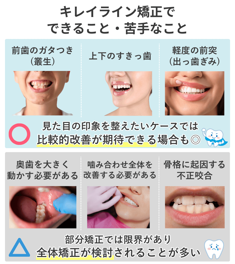キレイライン矯正でできること（前歯の軽度な乱れやすきっ歯など）と、苦手なこと（奥歯の大きな移動や骨格性の不正咬合など）を対比した図解表