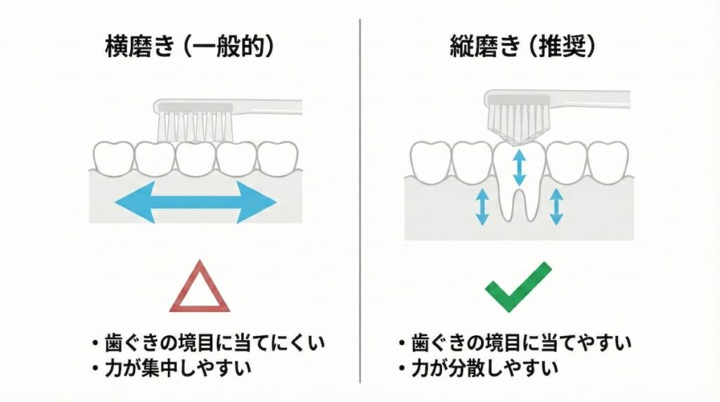 奇跡の歯ブラシで意識したい縦磨きと横磨きの違いを示した図
