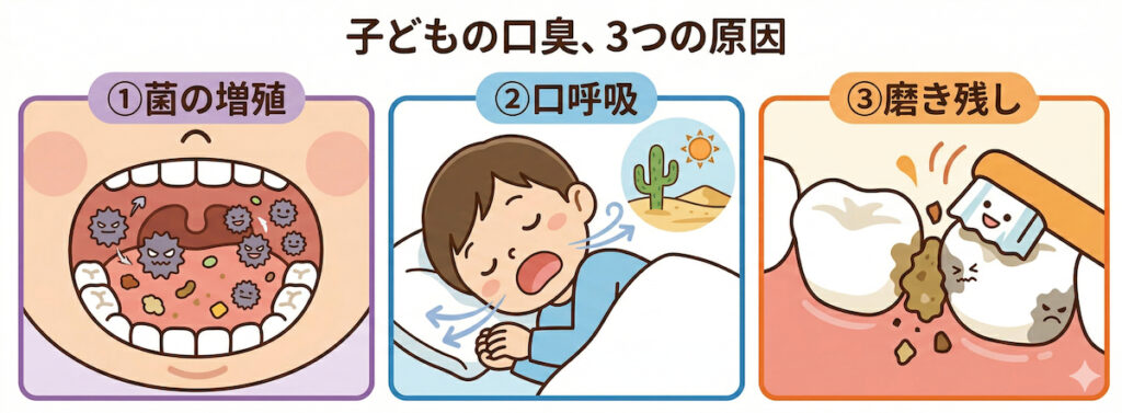 子どもの口臭の3大原因（①菌の増殖 ②口呼吸 ③磨き残し）をイラストで解説した図解