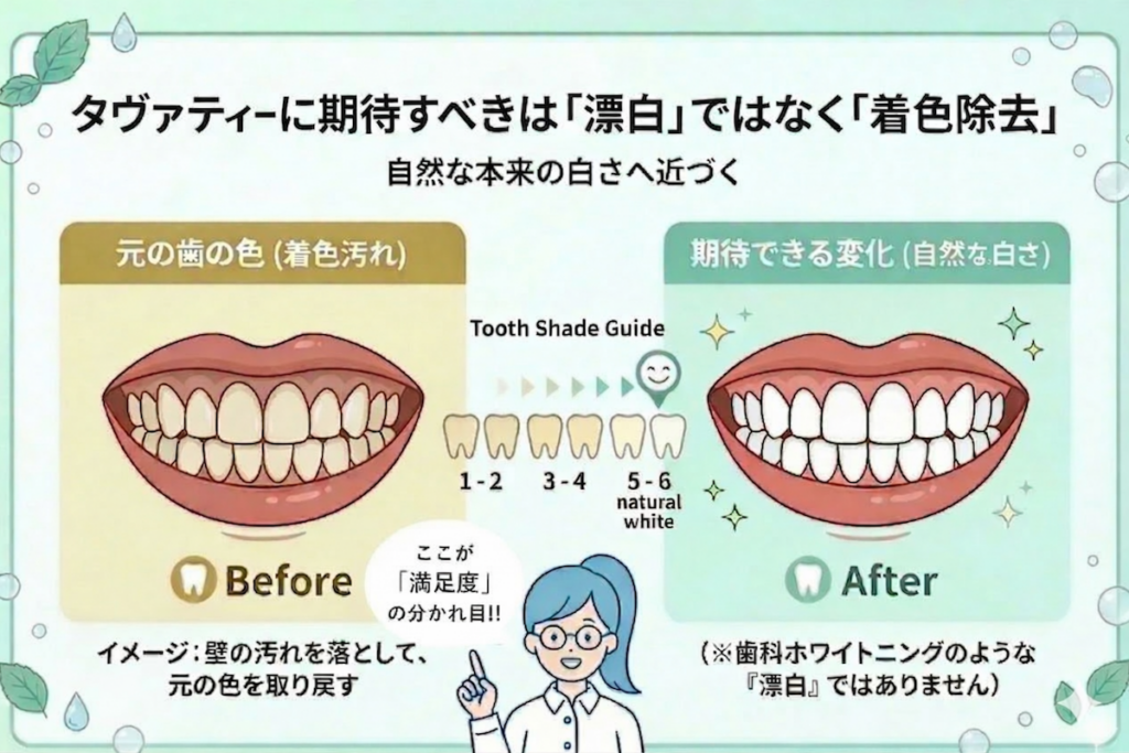 タバティーによる歯の着色除去効果のビフォーアフター。段階的なシェードガイドと注意書き付き